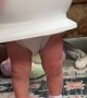 Toddler Gets Stuck in the Potty