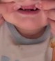 Baby With Vampire Teeth